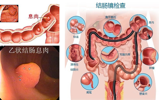 萎縮性胃炎真的“很嚇人”？看完這“七個事實(shí)”你就明白了