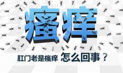 肛門瘙癢治不好嗎？先檢查病因就好辦！
